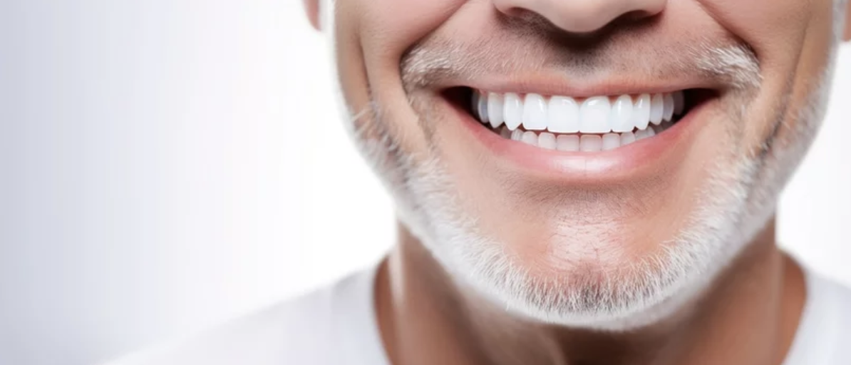 All On Four Dental Implants