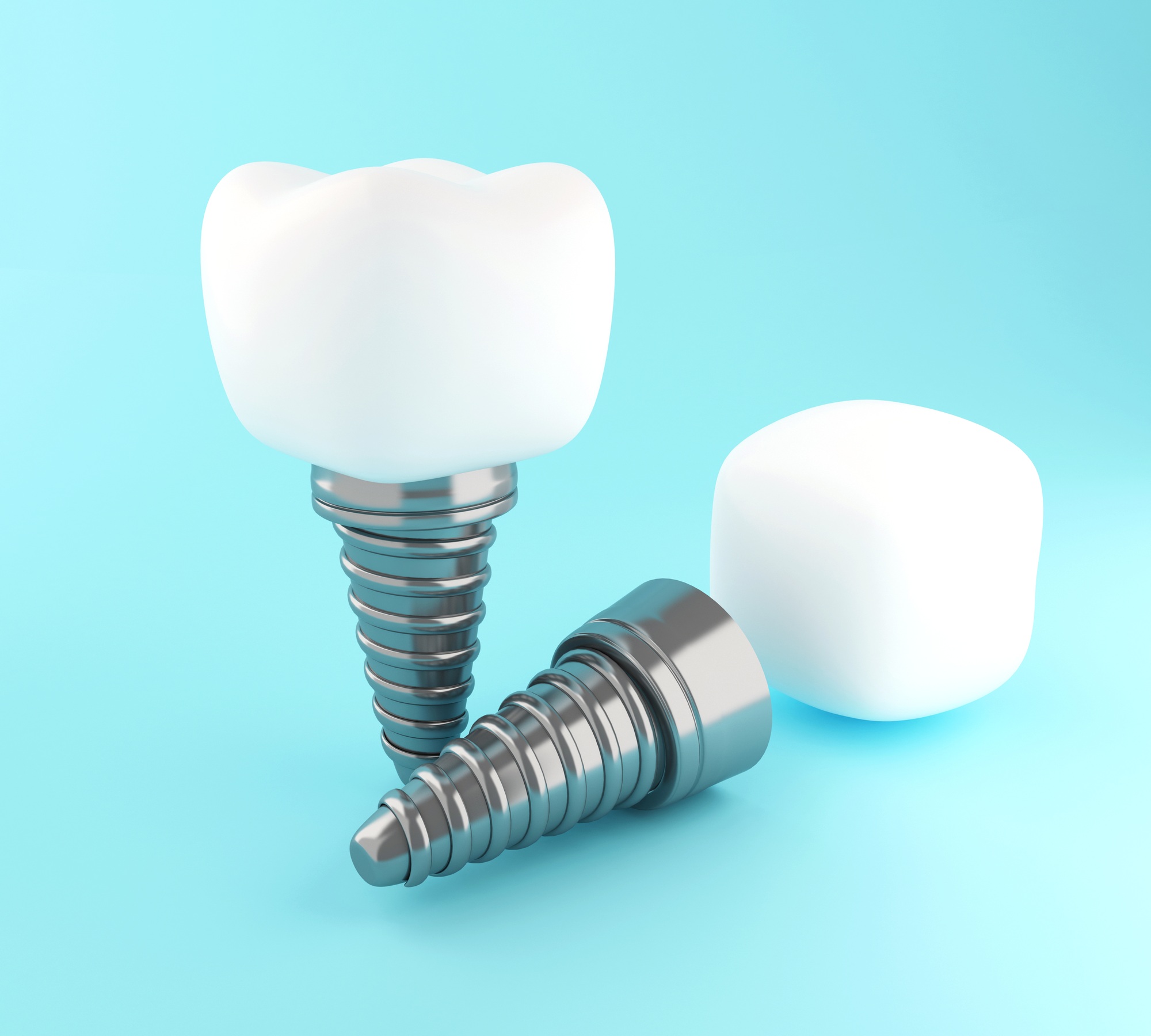 The True Cost of Dental Implants: Why Quality Matters