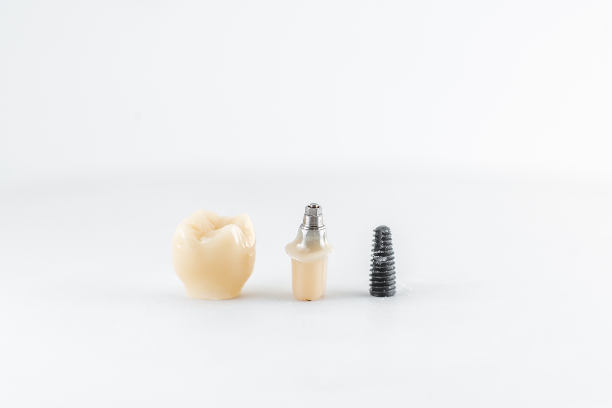 Dental Implant Cost in Johnson County: What to Actually Expect
