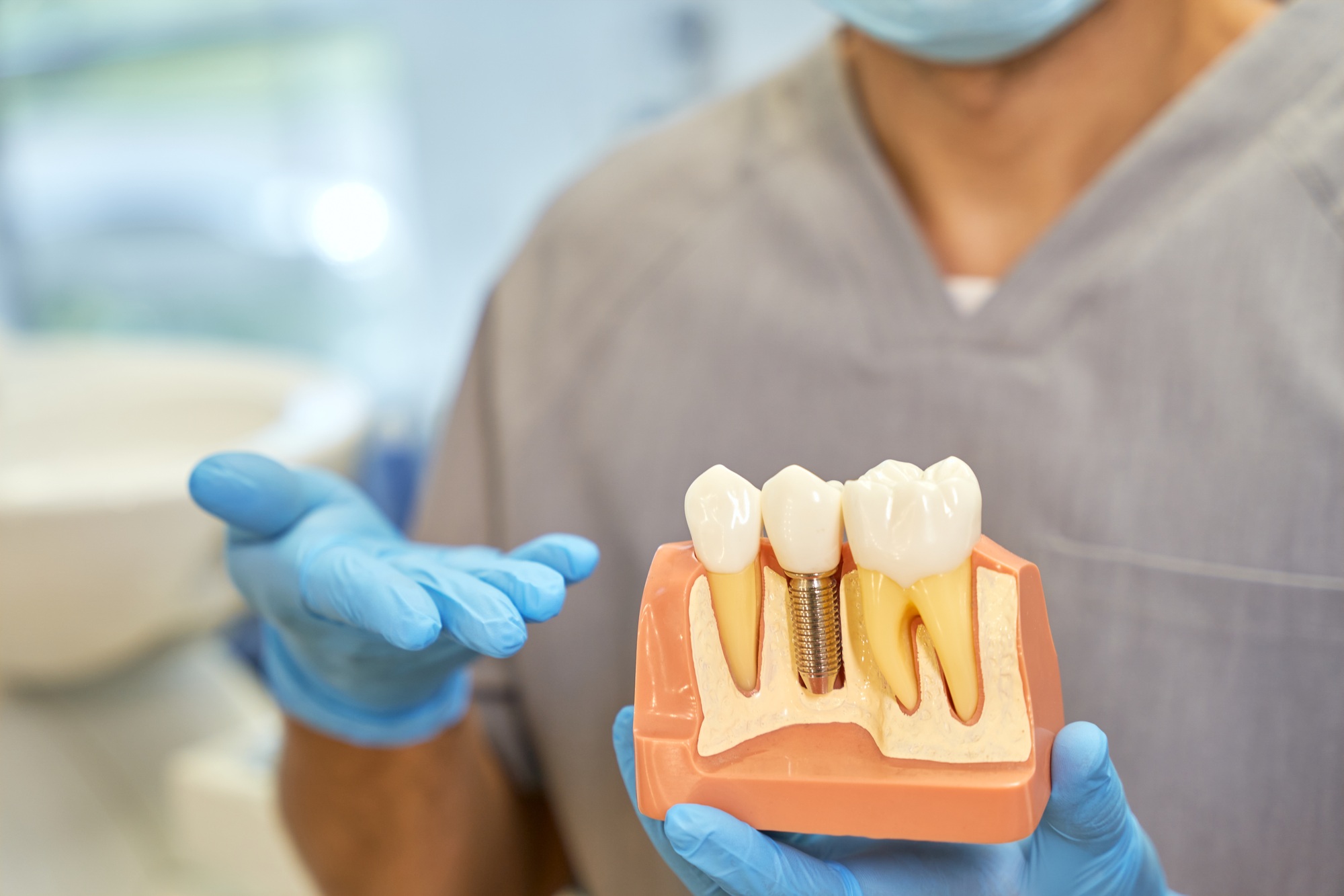 Get Dental Implants in Kansas City