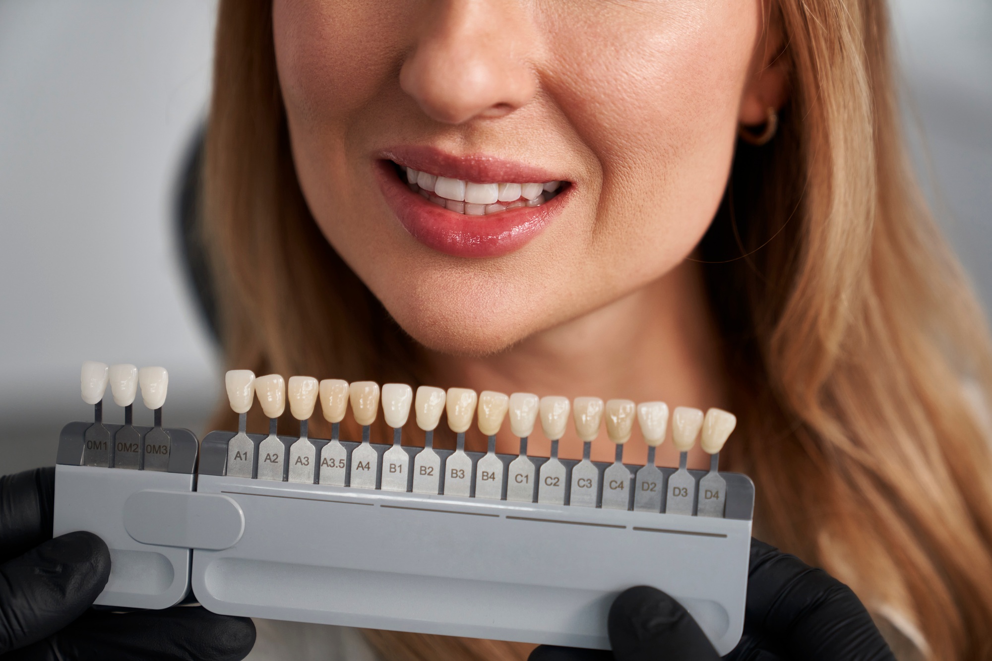 Woman having cosmetic dentistry at the dentist