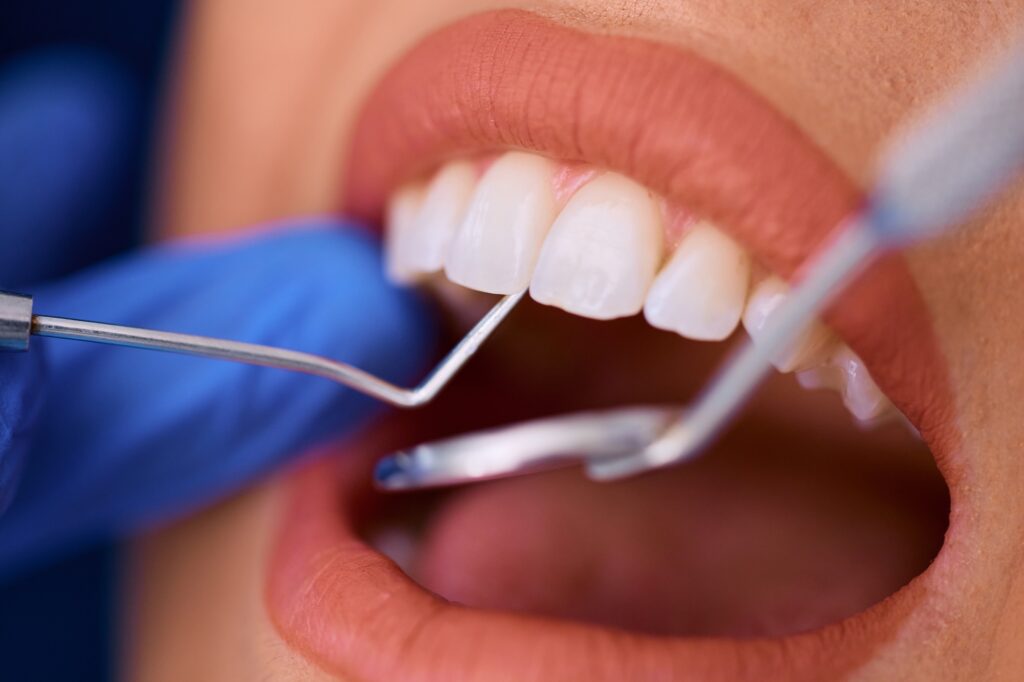 close up of woman having dental exam at dentist s office 