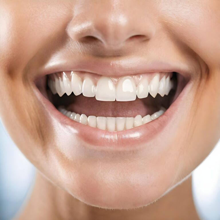 Porcelain Veneers in Overland Park, KS