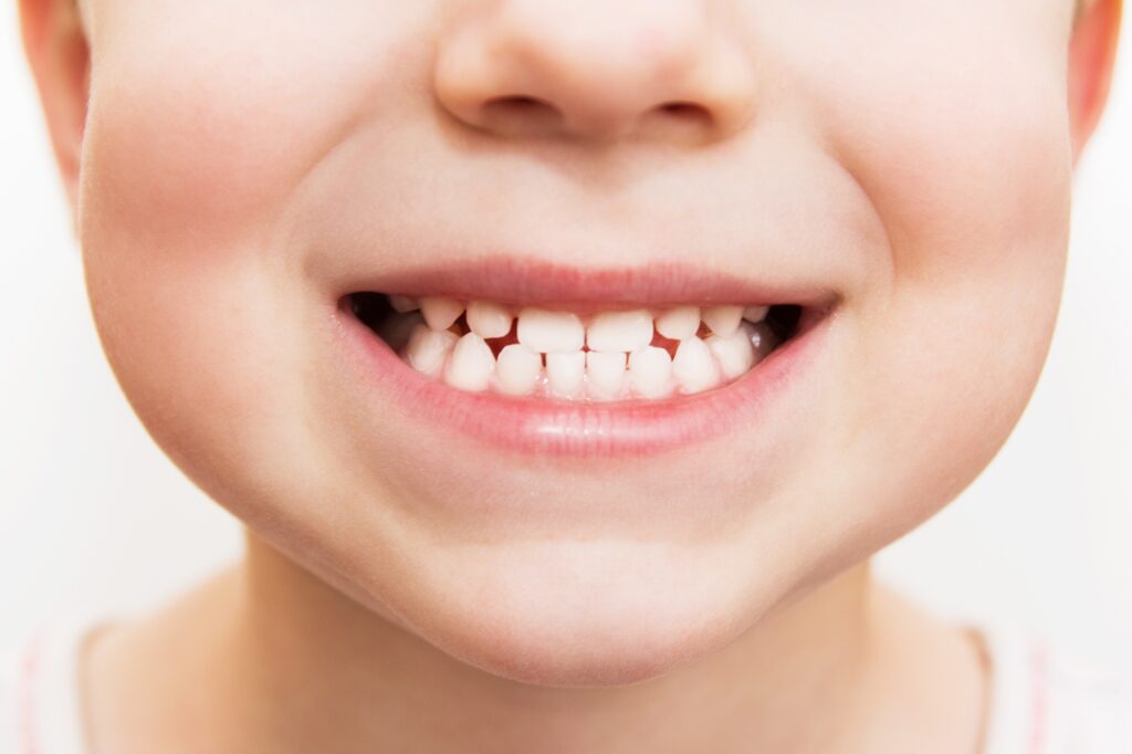 baby smile close. child teeth on a white isolated background.