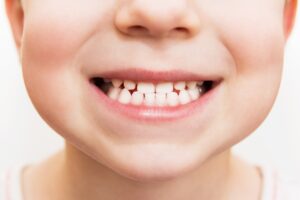 baby smile close. child teeth on a white isolated background.