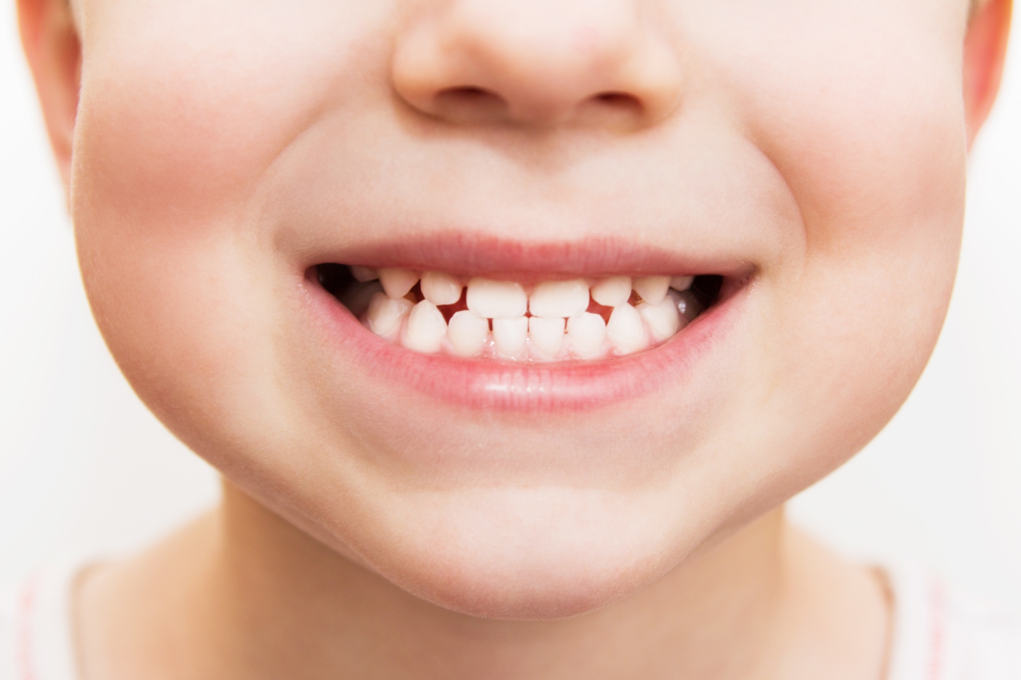 When Should Your Baby First See the Dentist? Sooner Than Most Parents Think