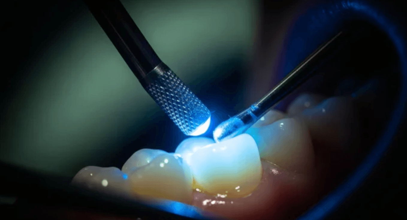 Cheapest Way to Fix Crooked Teeth in Kansas City: Affordable Options That Actually Work