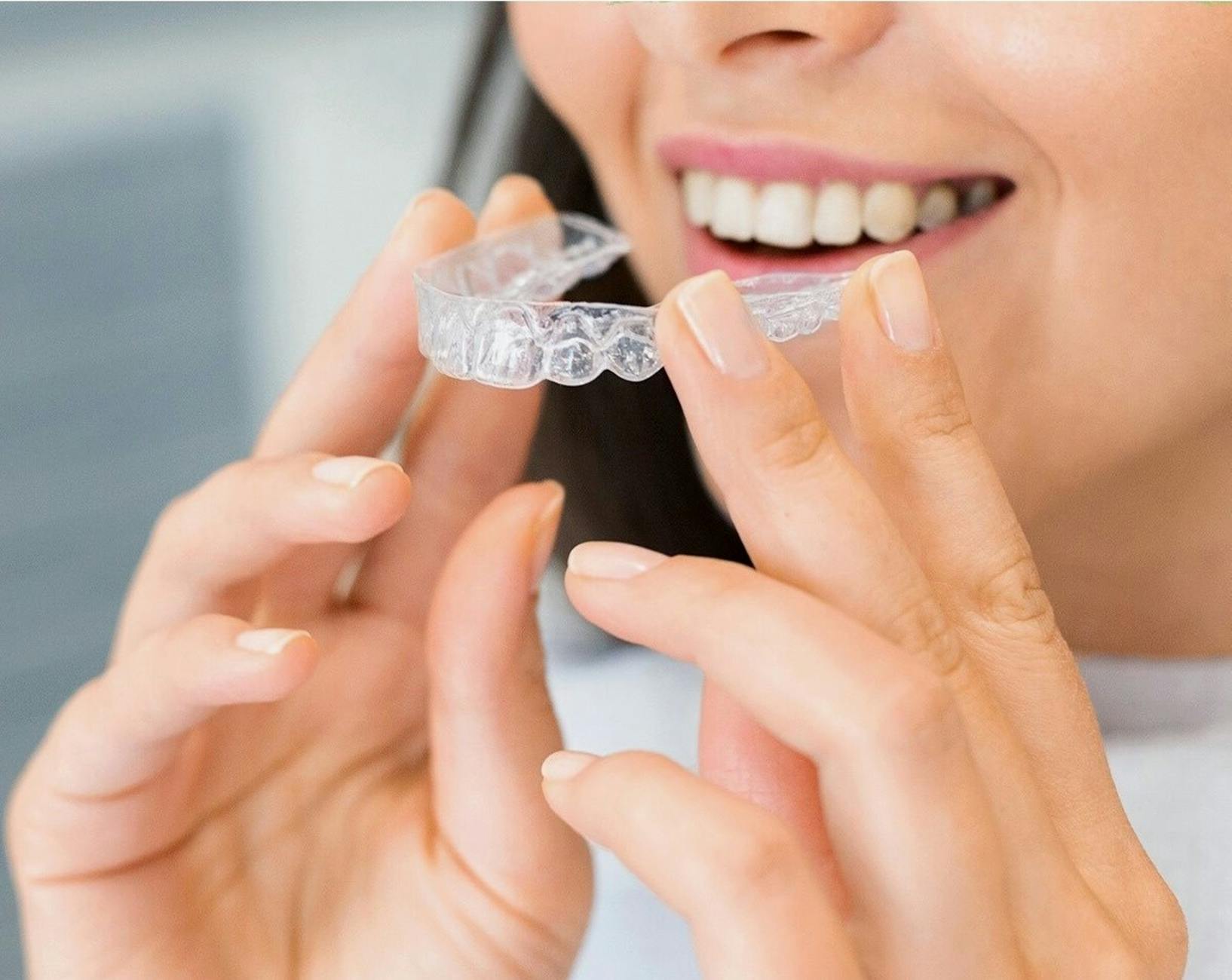 Invisalign vs Braces: The Complete Guide for Overland Park Parents in 2024