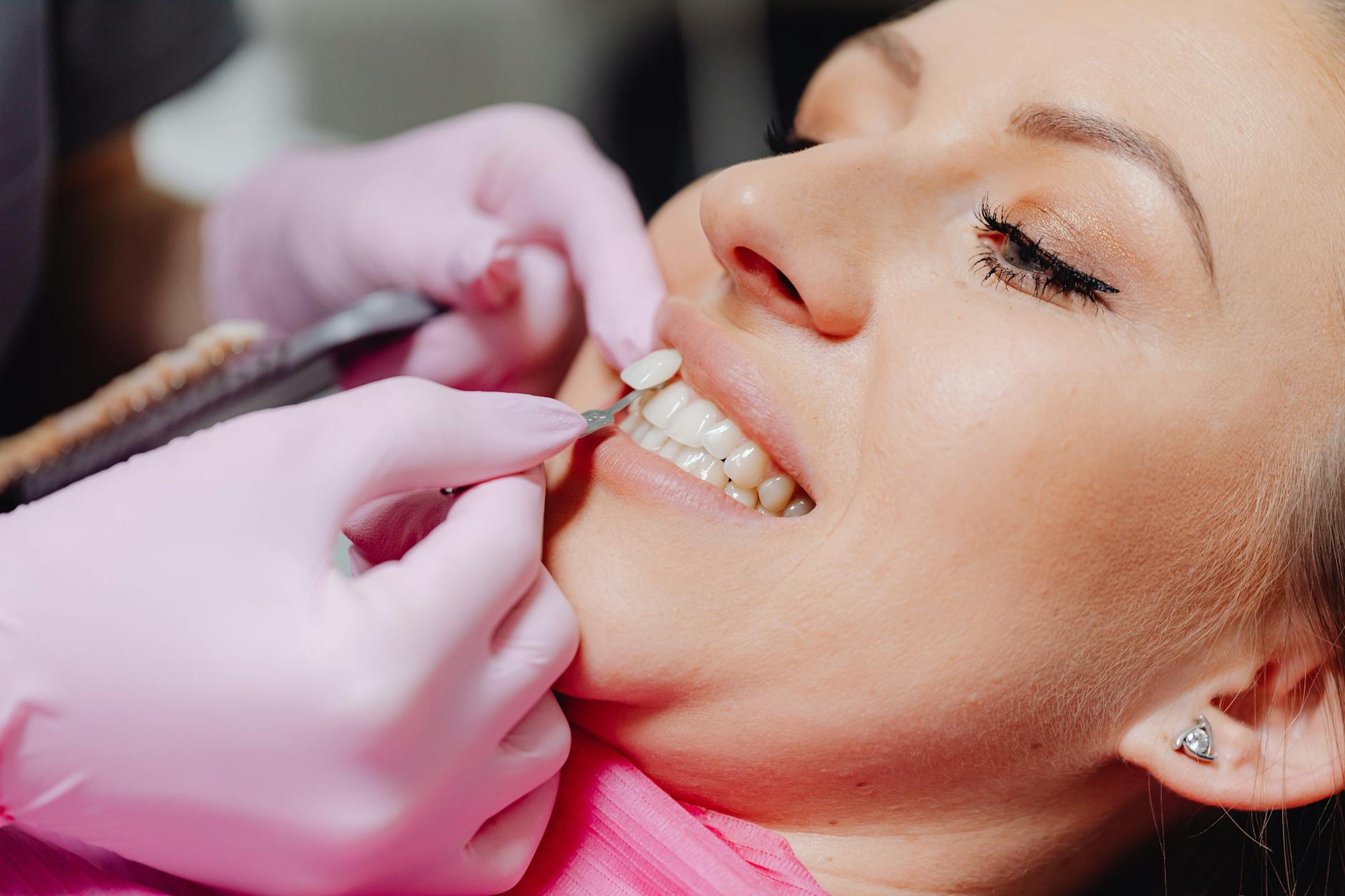dental veneers porcelain teeth cosmetic dentistry