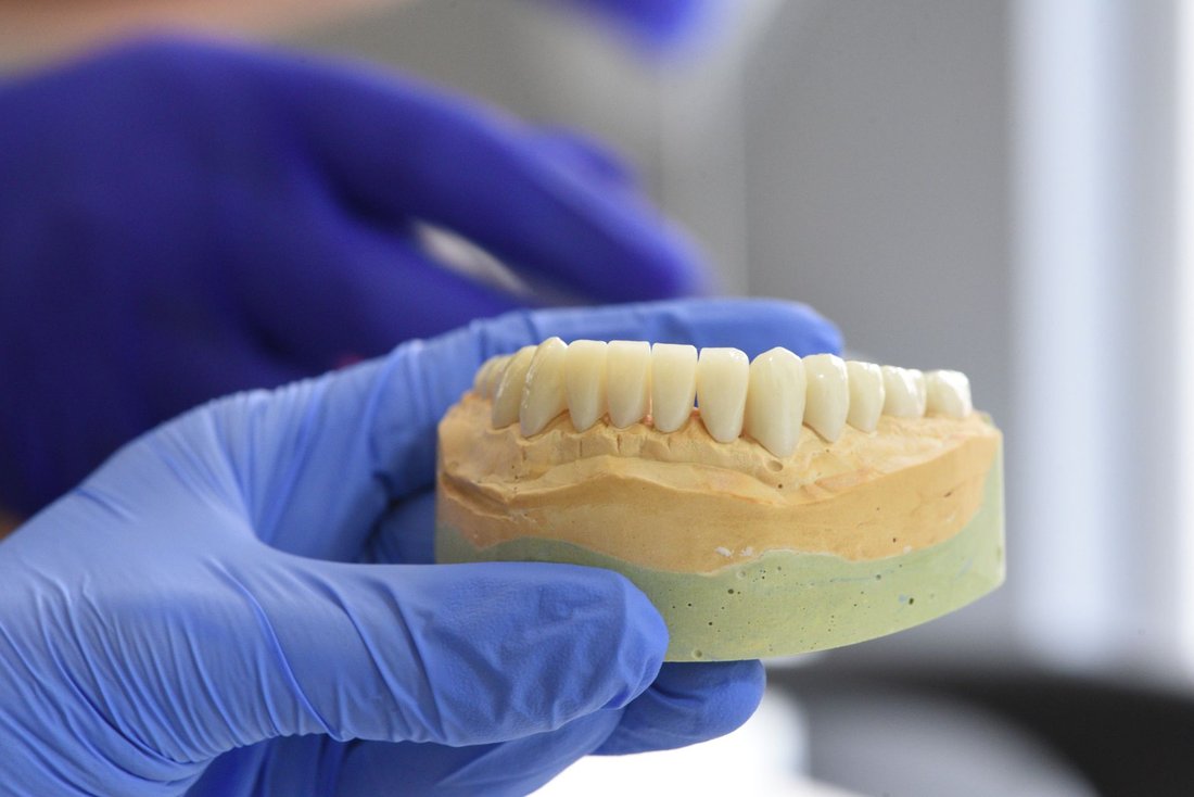 Crowns & Bridges at Love To Smile Dentistry