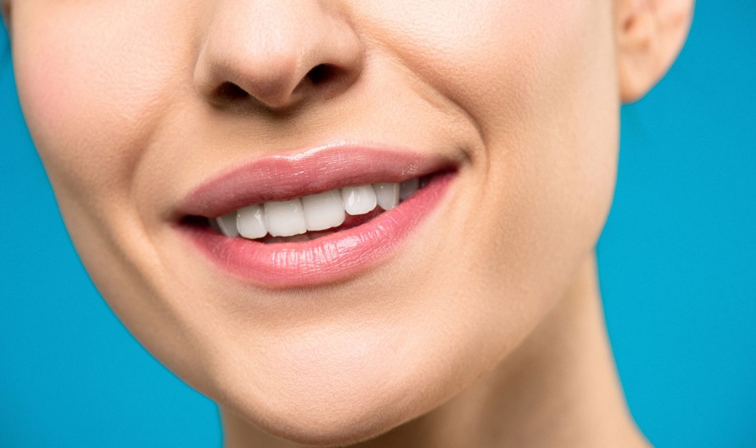Porcelain Veneers at Love To Smile, serving Grandview, MO
