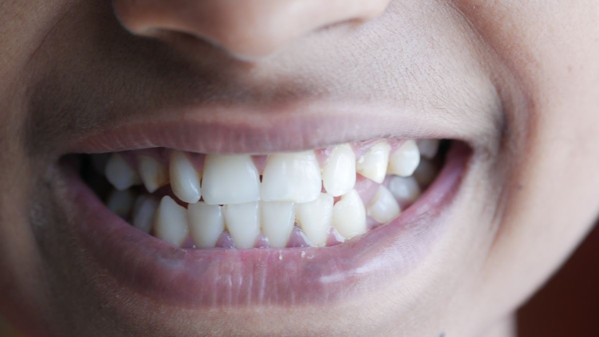 Close up of teeth and gumline in a natural smile