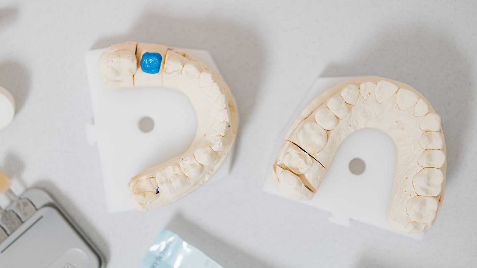 Dental models and a ceramic crown on a clinic worktop