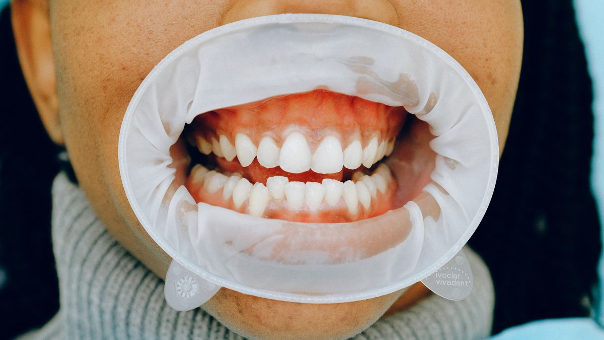 Close up view of gums and teeth during a dental exam