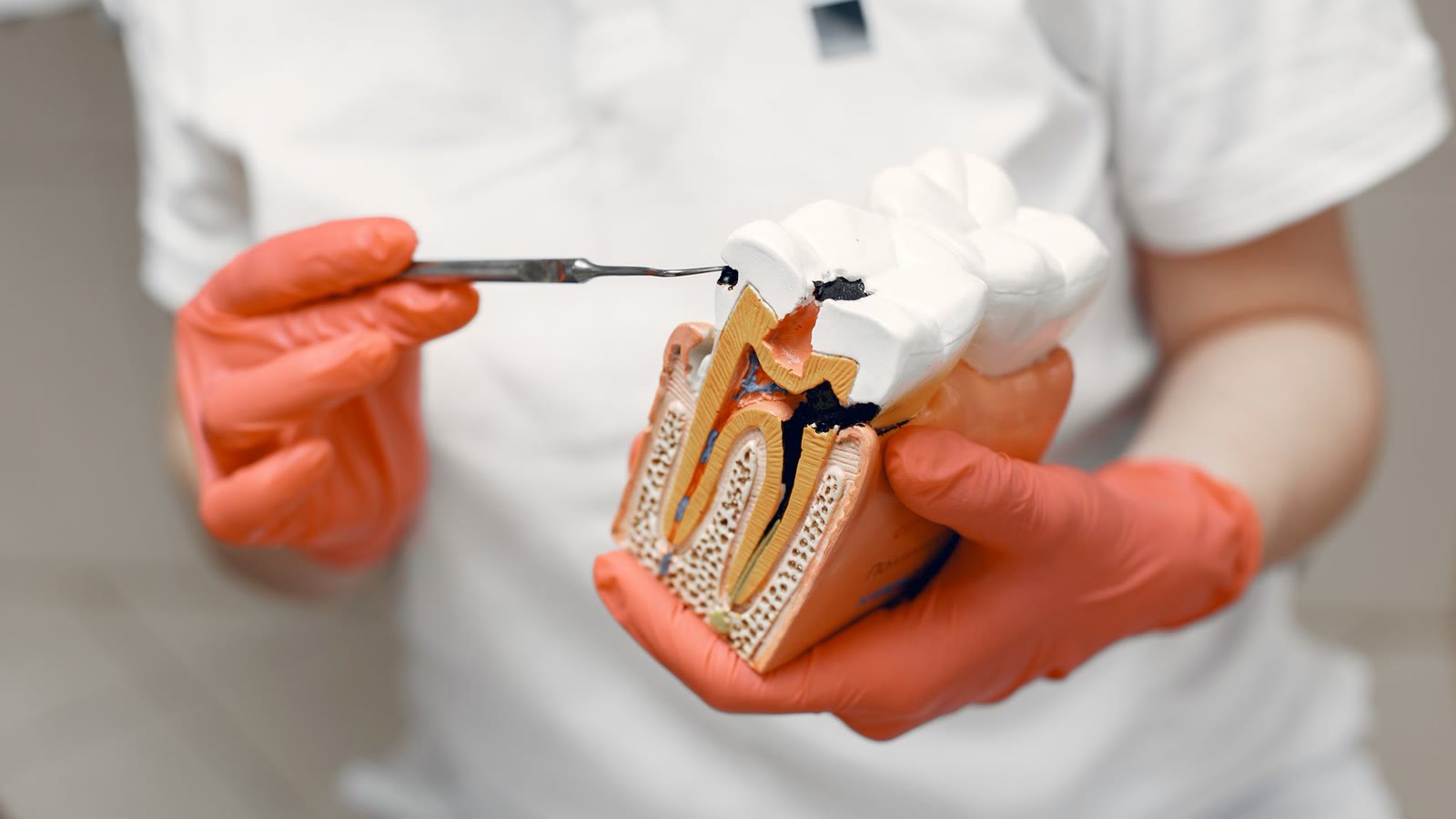 Gloved hands holding a cutaway model of a molar and its roots