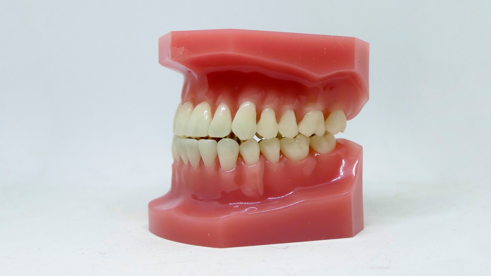 Can Invisalign Fix an Overbite or Underbite? Overland Park