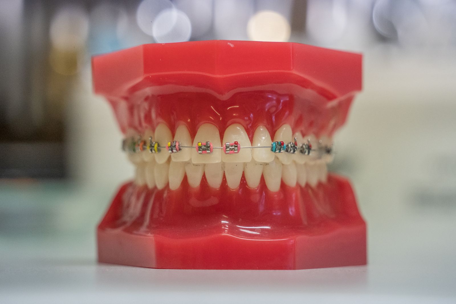 Model of human teeth with colorful braces, showcasing dental care and orthodontics