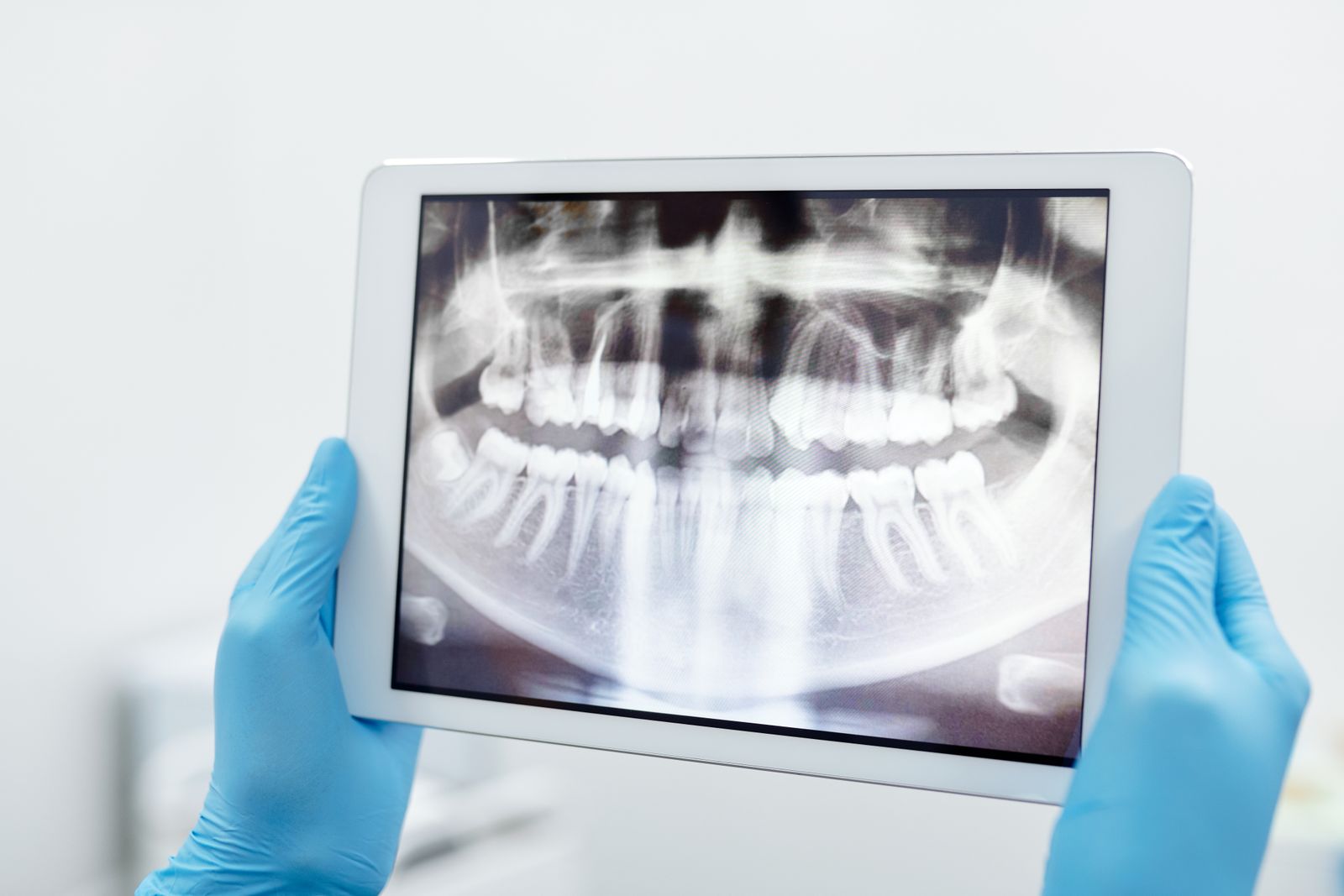 Blue-gloved hands holding a digital tablet displaying a detailed dental X-ray scan