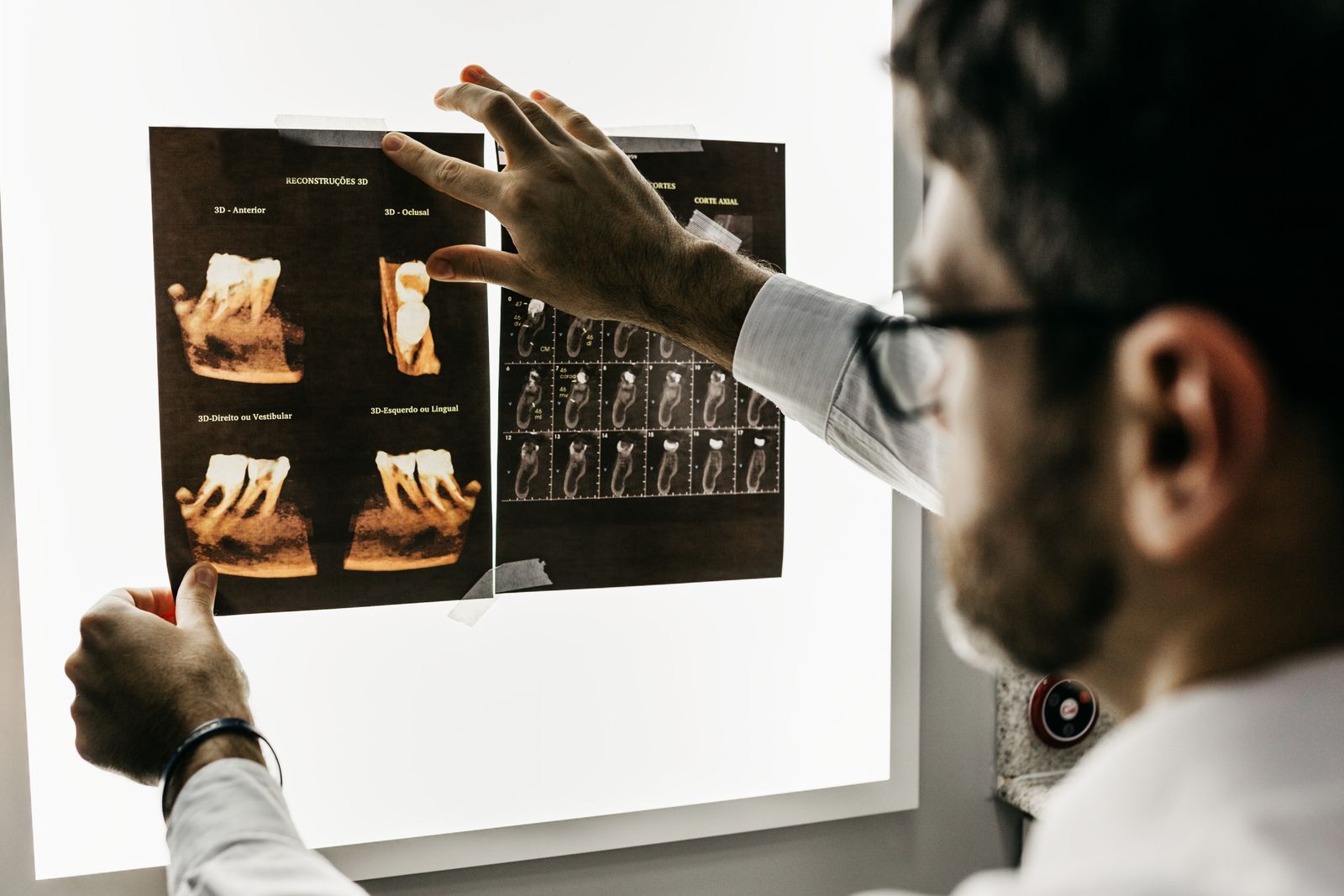 Dentist analyzing dental x-rays to assess patient teeth health in a clinical setting