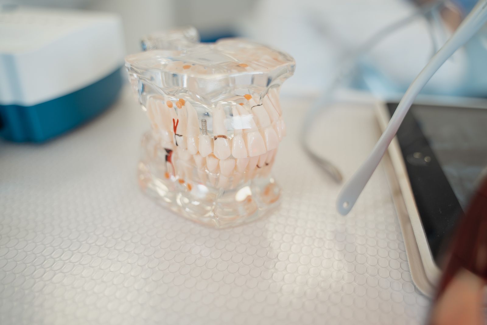 Close-up of a dental model on a clinic table, showcasing teeth anatomy
