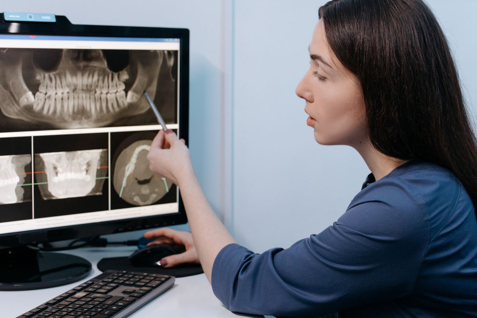 Female dentist examining dental X-ray images on computer screen in clinic