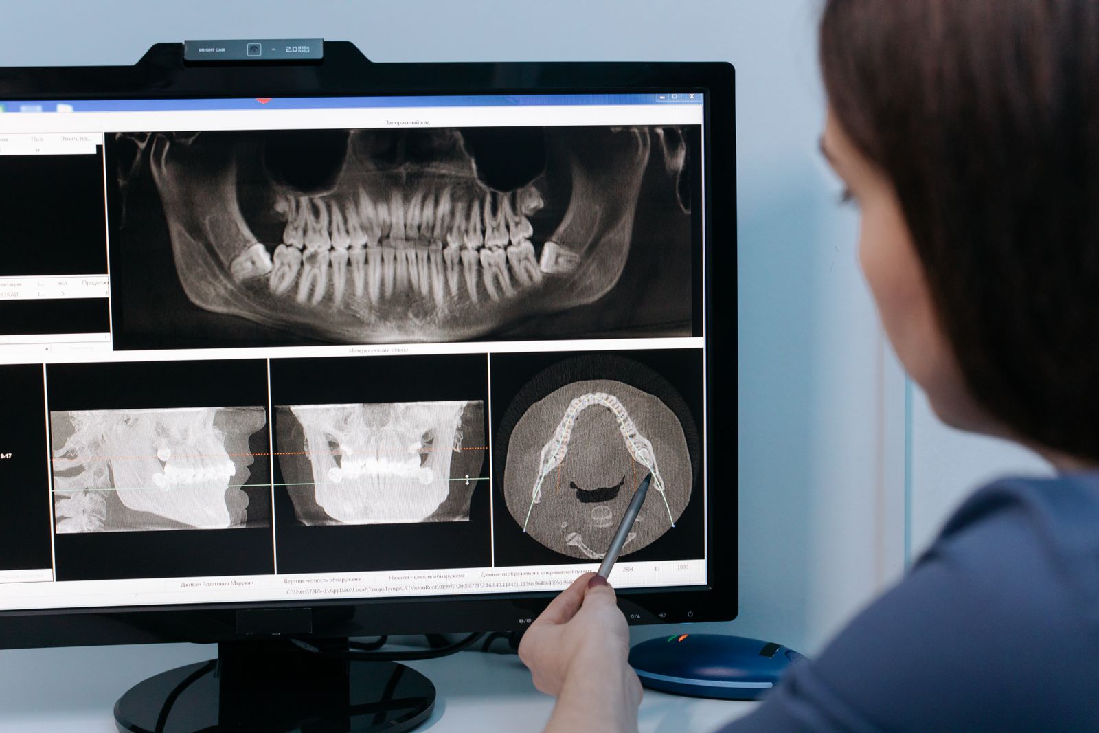 A dentist examines dental X-rays on a computer screen using a stylus for detailed analysis