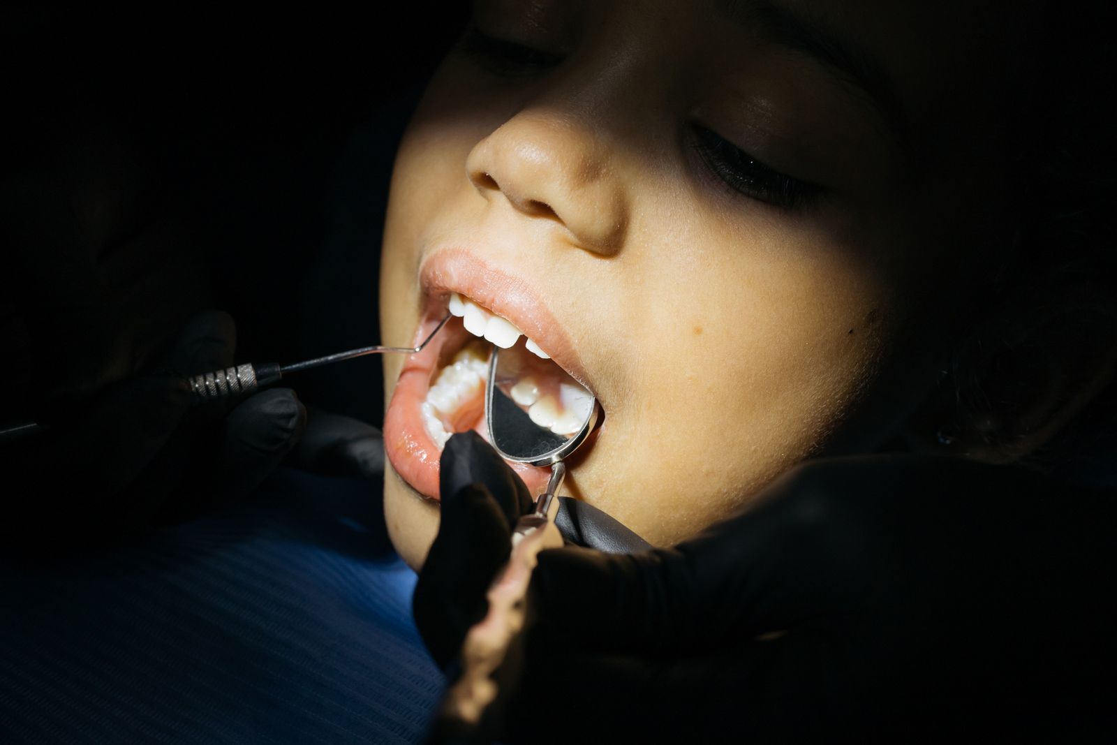 Close-up of a child undergoing a dental examination at a clinic