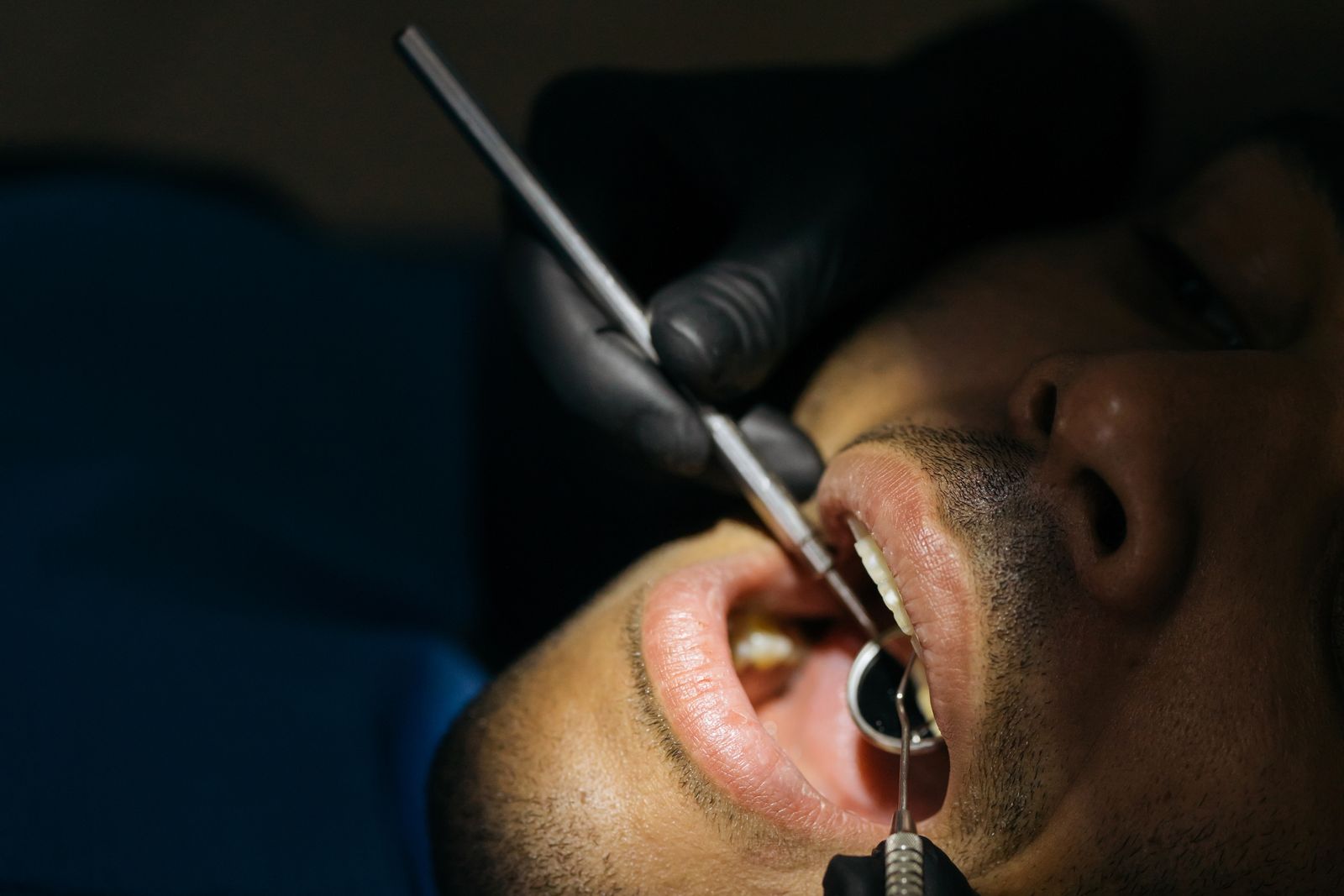 Detailed close-up of a dental examination with instruments in a clinical setting