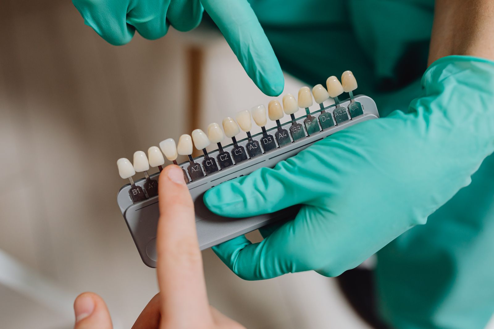 Dental professional with gloves pointing to a dental shade guide in a clinic