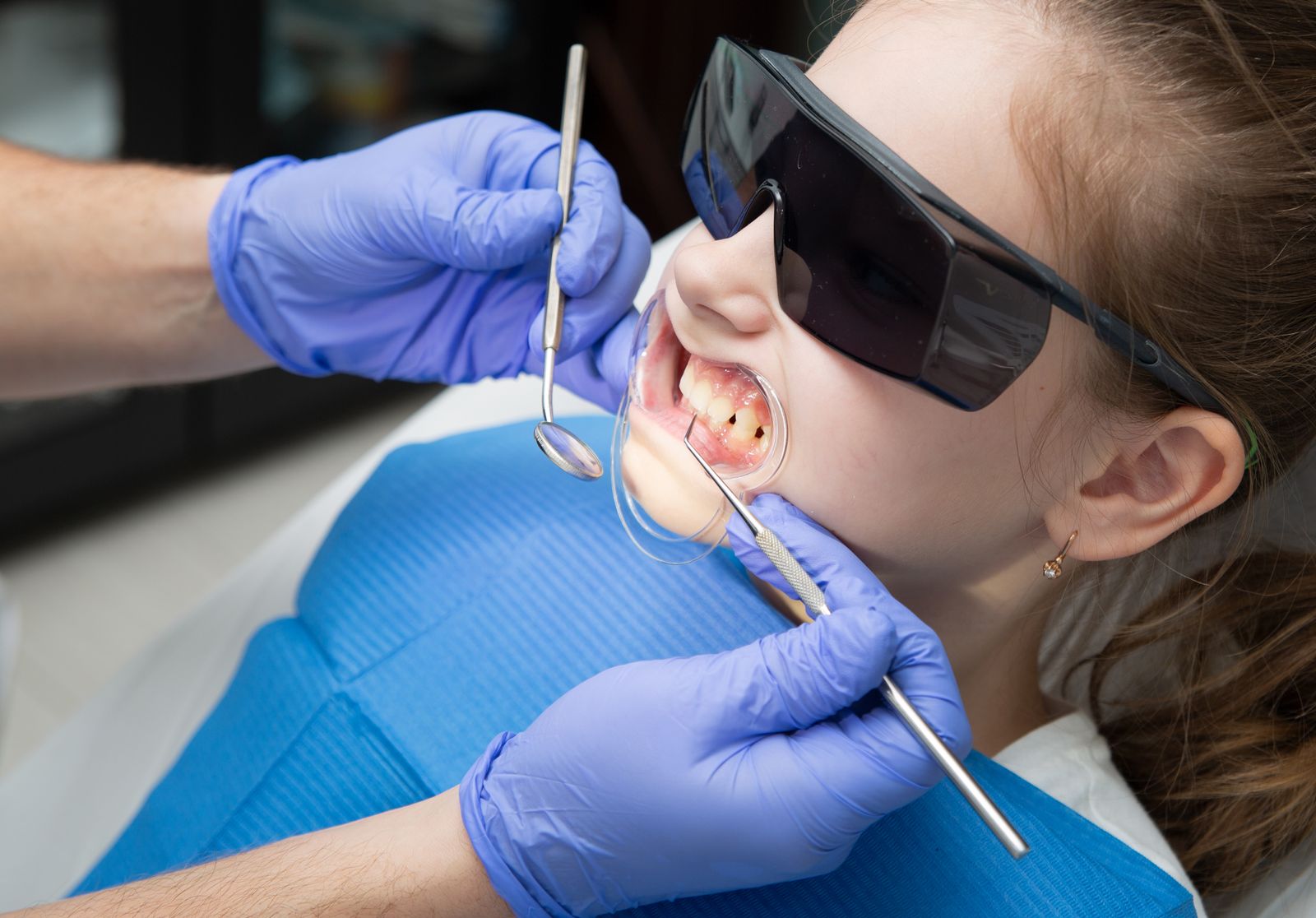 A child receiving dental care wearing protective goggles during treatment